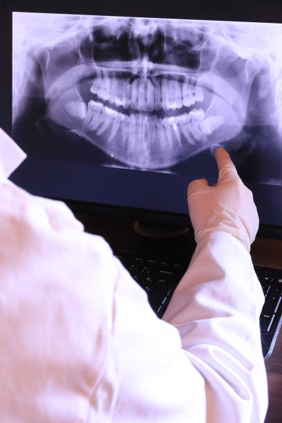 Best Broken or Cracked Tooth Emergency Dentist in Paris, MO